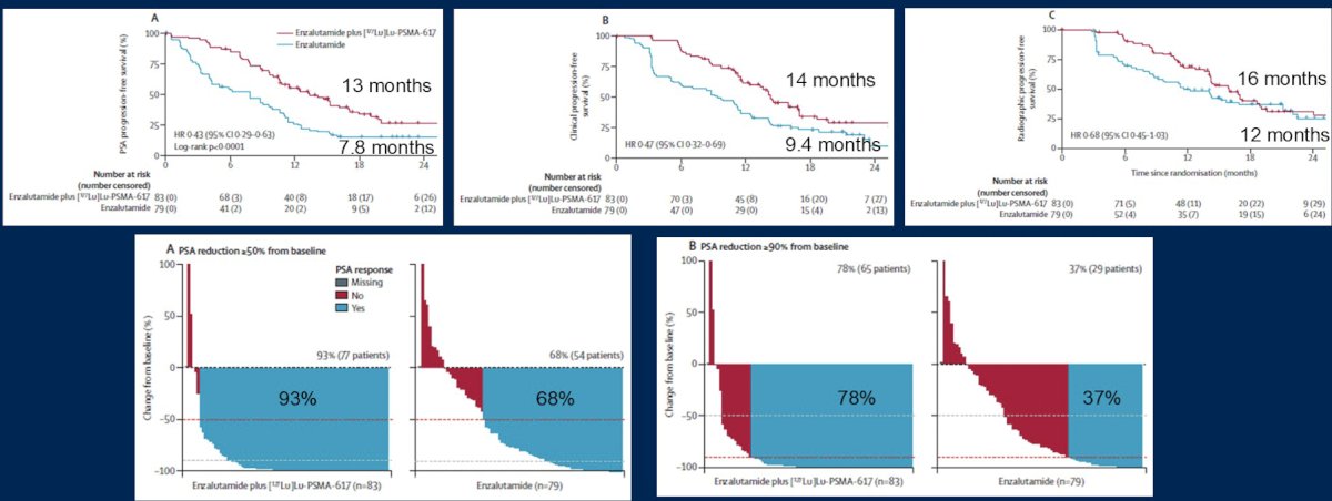In the enzalutamide + 177Lu-PSMA-617 arm, 81% of patients received four doses of 177Lu-PSMA-617. Over a median follow up of 20 months (IQR 18-21), PSA progression free survival was longer with enzalutamide + 177Lu-PSMA-617 versus enzalutamide-alone (median 13 versus 7.8 months; HR 0.43, 95% CI 0.29-0.63, p < 0.001). Additionally, other clinical outcomes, including PSA50 and PSA90 improved with 177Lu-PSMA-617 + enzalutamide: