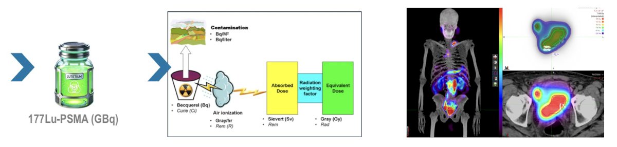 Dr. Cortes notes that GBq from 177Lu-PSMA therapy transform to Gy, with Gy representing real therapy effect when matched with radioligand therapy response:
