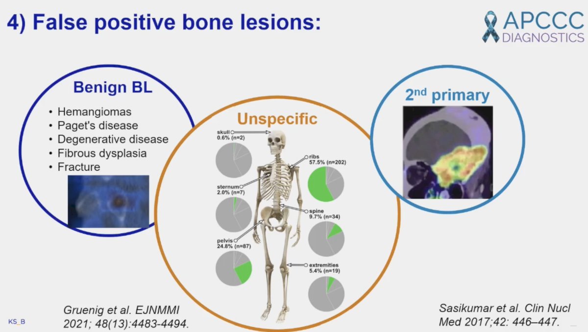 One must also consider 2nd primary lesions, as well as ‘unspecific’ bone lesions.