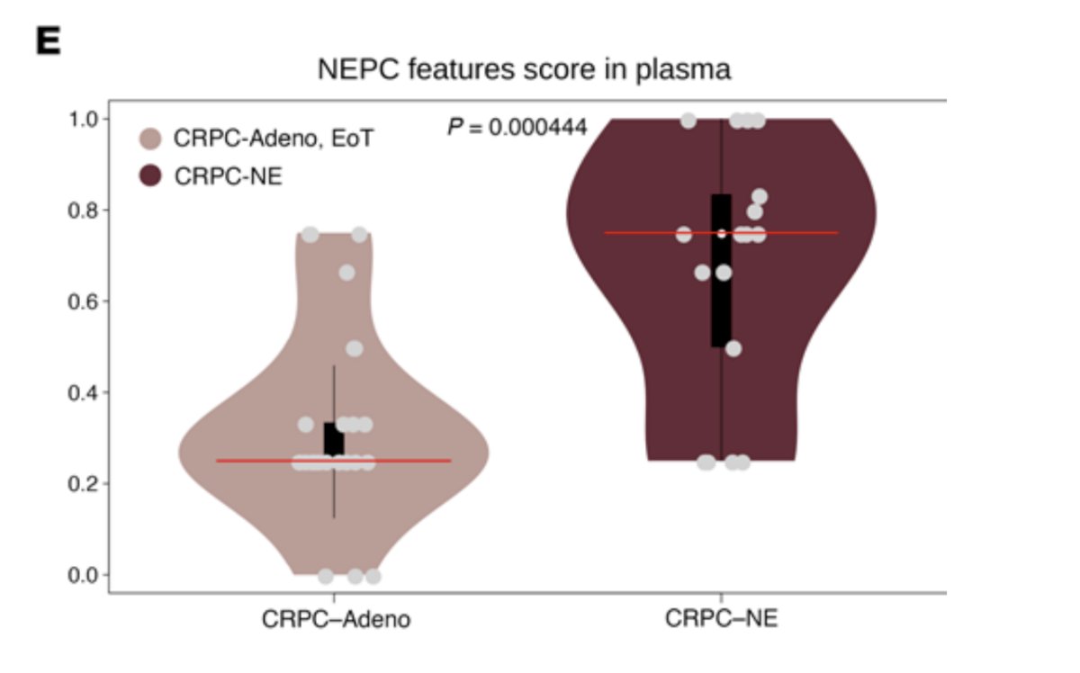 Work from Beltran et al.5 using whole-exome sequencing and whole-genome bisulfite sequencing of cfDNA and of matched metastatic tumor biopsies from patients with metastatic prostate adenocarcinoma and CRPC-neuroendocrine has identified CRPC-neuroendocrine features detectable in the circulation