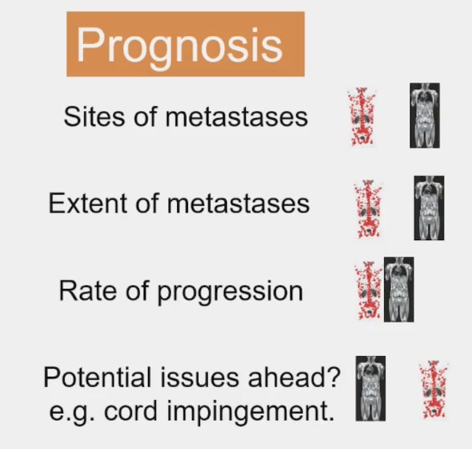 With regards to the information, Dr. O’Sullivan started by discussing prognosis: (i) sites of metastasis - both whole body MRI and PSMA PET are adequate, with PSMA PET slightly better, (ii) extent of metastasis - both whole body MRI and PSMA PET are adequate, with PSMA PET slightly better, (iii) rate of progression - both whole body MRI and PSMA PET are adequate, with PSMA PET slightly better and iv) potential issues ahead (ie. cord impingement) - both whole body MRI and PSMA PET are adequate, with whole body MRI slightly better
