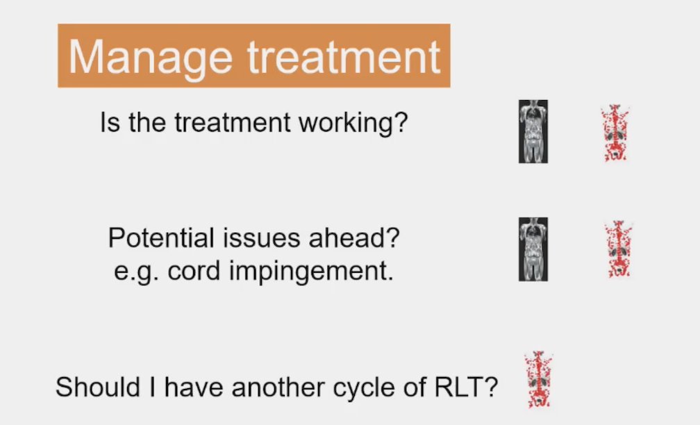 For managing treatment, Dr. O’Sullivan notes: (i) is treatment working? both whole body MRI and PSMA PET are adequate, with whole body MRI slightly better, (ii) are there potential issues ahead (ie. cord impingement)? both whole body MRI and PSMA PET are adequate, with whole body MRI slightly better, (iii) should I have another cycle of radioligand therapy? PSMA PET is clearly better