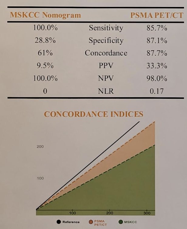 Using only PSMA PET for predictive assessment of nodal metastases yielded an overall sensitivity of 85.7%, specificity of 87.1%, PPV of 33.3%, and NPV of 98.0%. NLR was 0.17 and PSMA PET showed a concordance rate of 0.87