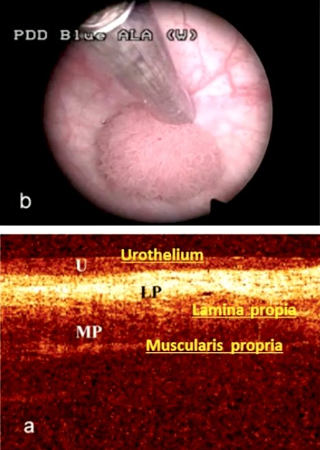coherence tomography.jpg