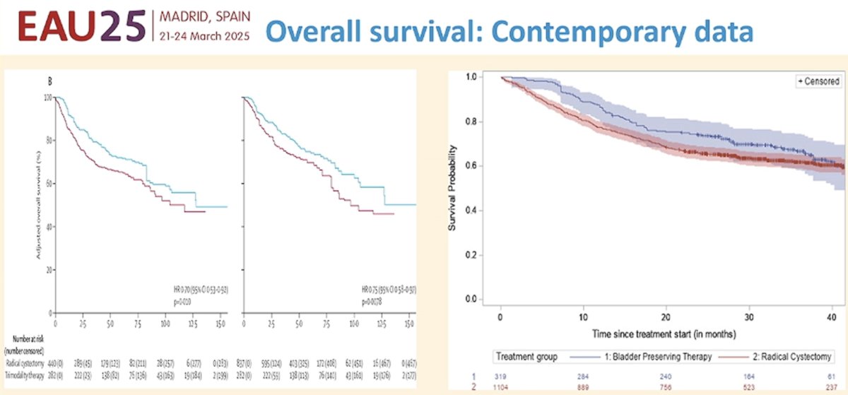 Next, Dr. Ananya Choudhury argued that radiation was mandatory with systemic therapy. She noted that there is now high-quality evidence to support the oncological equivalence of radical cystectomy and TMT in well-selected patients.