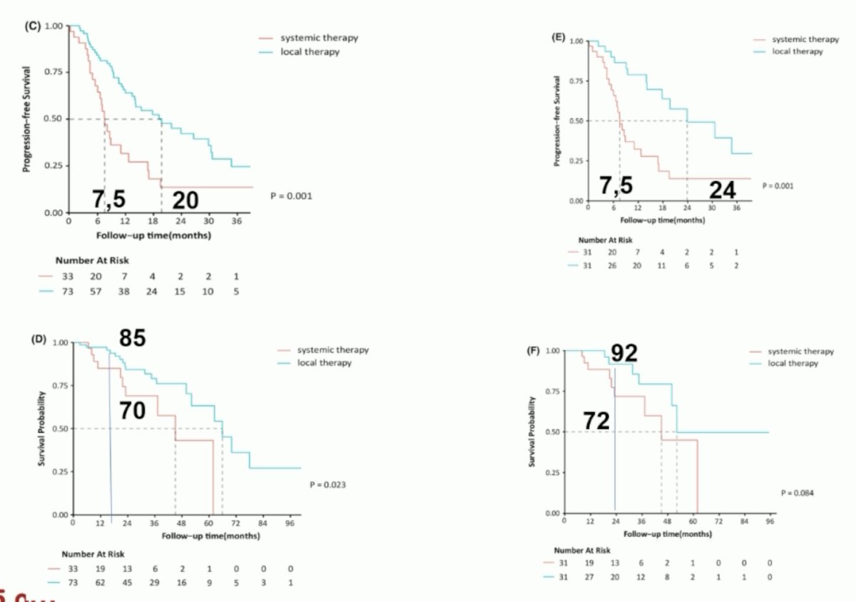 What did the results of this study show? A matched analysis demonstrated that patients who underwent local therapy had superior progression-free (PFS) and overall survivals (OS).