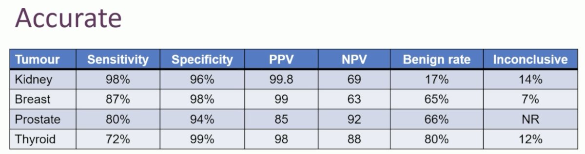 As demonstrated in the table below, RMBs have a sensitivity and specificity of 98% and 96%, respectively. Notably, however, the negative predictive value is only 69%, which means that 31% of patients with ‘negative’ RMBs harbor malignant masses.