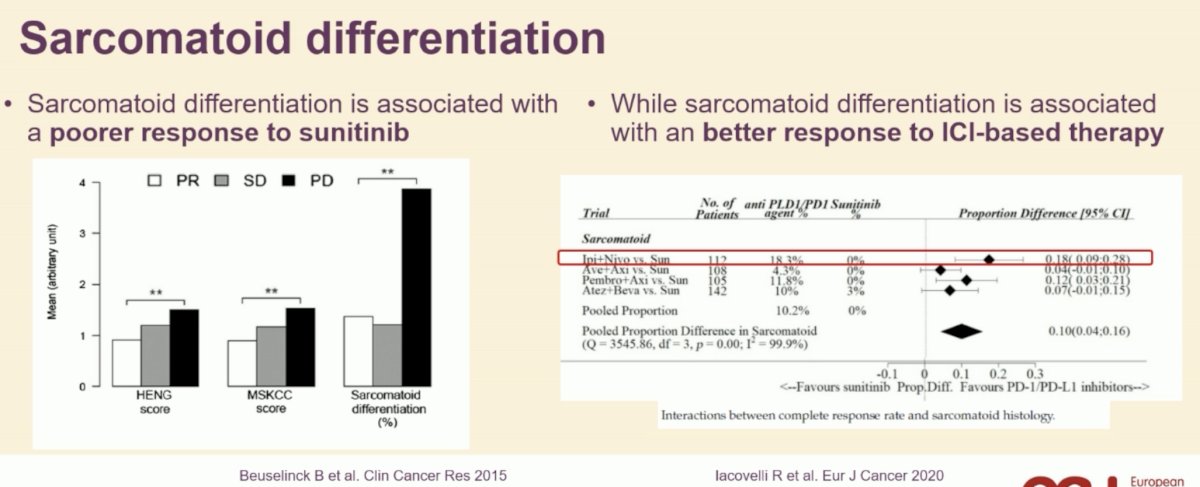 What about histologic biomarkers? Sarcomatoid differentiation is associated with a poorer response to sunitinib, but better response to immune checkpoint inhibitor therapy.