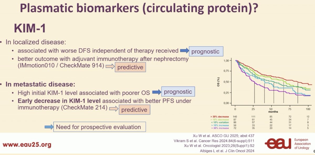 Kidney Injury Molecule-1 (KIM-1) is a circulating protein plasma biomarker that in localized disease has been shown to be associated with: