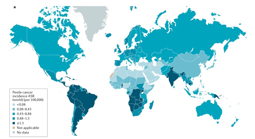 Similar trends were observed in data from the Global Society of Rare Genitourinary Tumors (GSRGT) survey, which highlighted significant geographical disparities in disease burden, with South America reporting the highest incidence. Risk factors positively associated with higher penile cancer incidence included alcohol consumption, human immunodeficiency virus (HIV) infection, and unsafe sexual practices