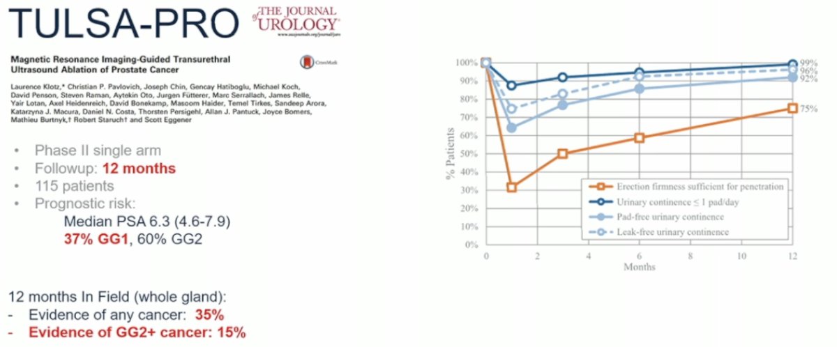 Dr. Nagar briefly discussed the TULSA-PRO trial, a Phase II single-arm study with a 12-month follow-up. A total of 115 patients were enrolled, with a median PSA of 6.3 ng/mL; 37% had Grade Group 1 disease and 60% had Grade Group 2 disease. At 12 months, within the in-field treatment area, evidence of any cancer was found in 35% of patients, and evidence of Grade Group 2 or higher cancer was found in 15%. However, while urinary continence and erectile function initially declined following treatment, both recovered to near-baseline levels by one year.9