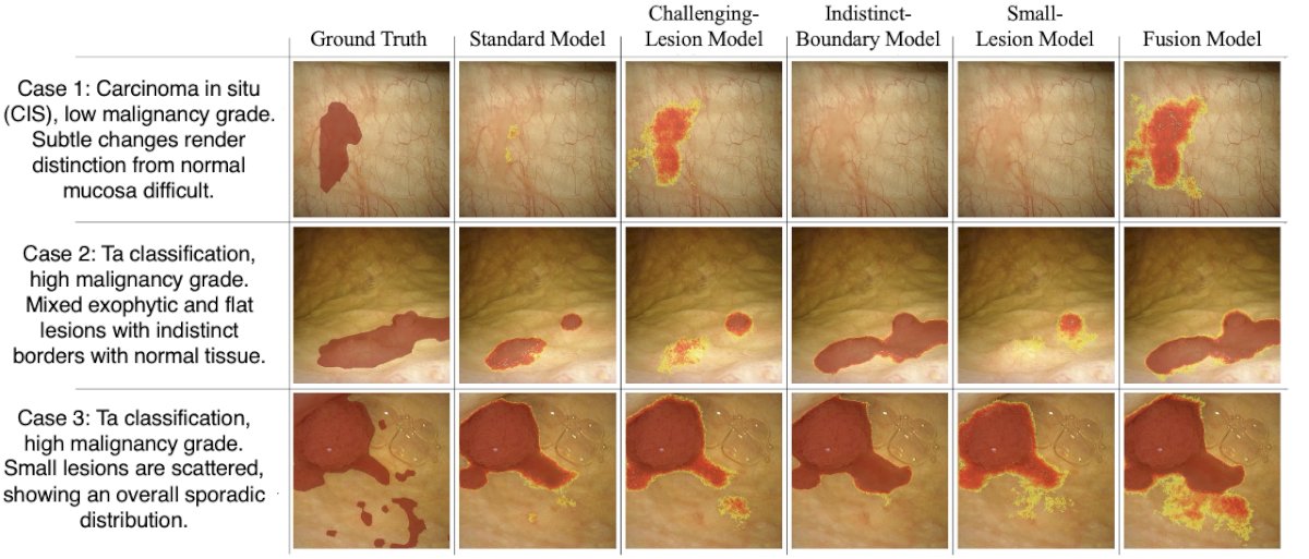 Figure 2: Comparison of specialized bladder lesion detection models across three clinical cases.