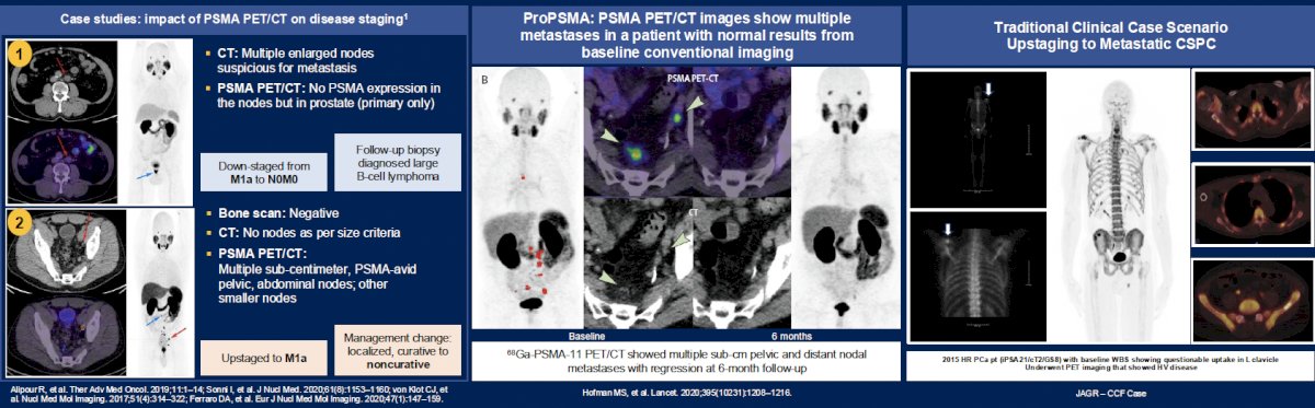 But what about the ‘real self’ discovery phase we find ourselves in? He argued that notable challenges remain. Imaging success has been transformational, but challenges in interpretation and applicability for some remain.