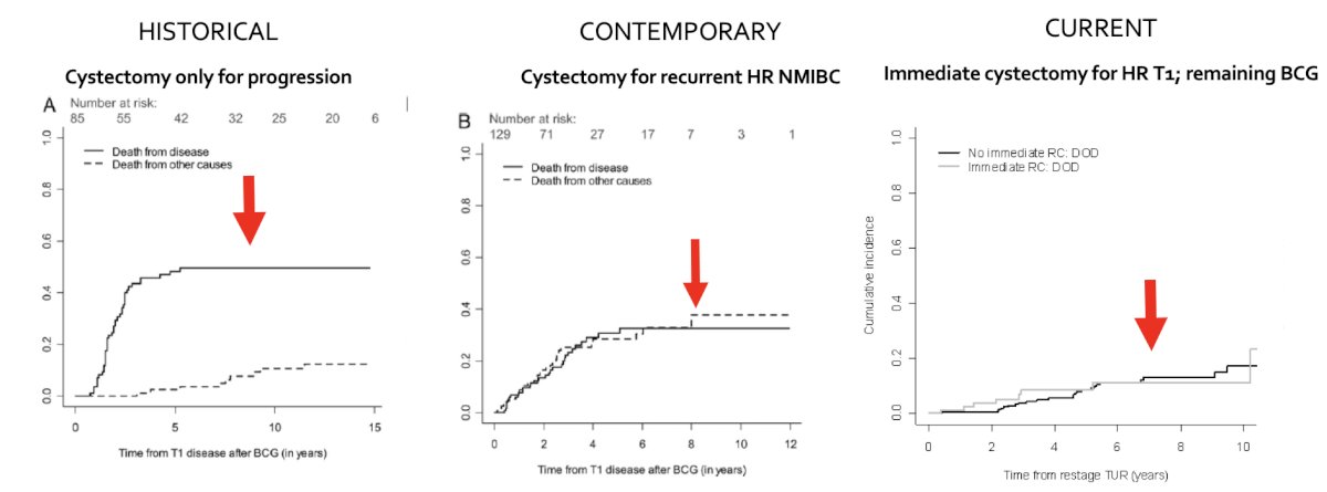 With regards to high risk (T1) bladder cancer, Dr. Bochner notes that there has been changing treatment patterns: