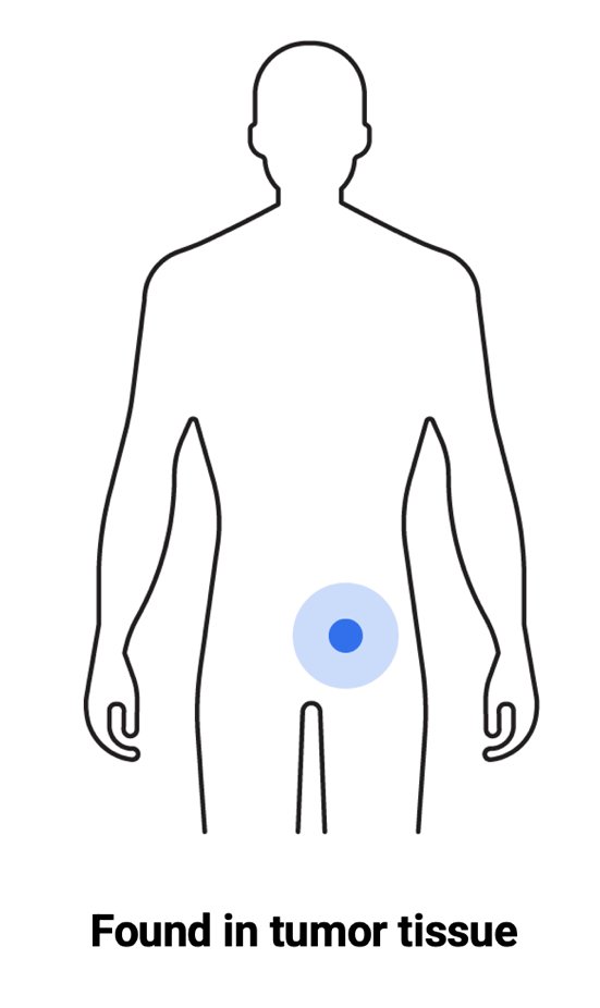 Somatic testing is used to identify genomic alterations that are present only in the tumor cells. This testing is performed on a tumor biopsy or surgical resection specimen and is aimed at guiding treatment decisions based on the molecular profile of the cancer. Unlike germline testing, somatic testing does not provide information about inherited cancer risk, as the alterations are not present in all cells of the body.