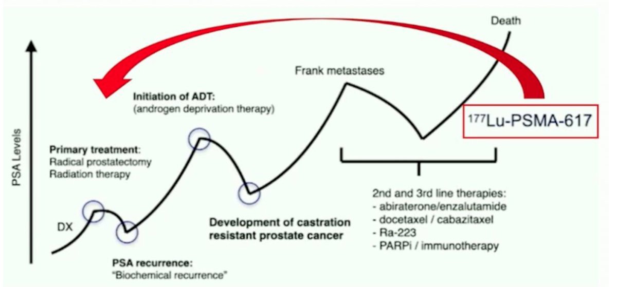 Radioligand therapy currently used in the advanced mCRPC setting. However, as research progresses, there is growing interest in moving 177Lu-PSMA earlier in the disease course even potentially into the primary treatment setting. Ongoing trials aim to explore its integration alongside or in place of standard treatments such as surgery, radiation, or systemic therapy in high-risk or oligometastatic disease.