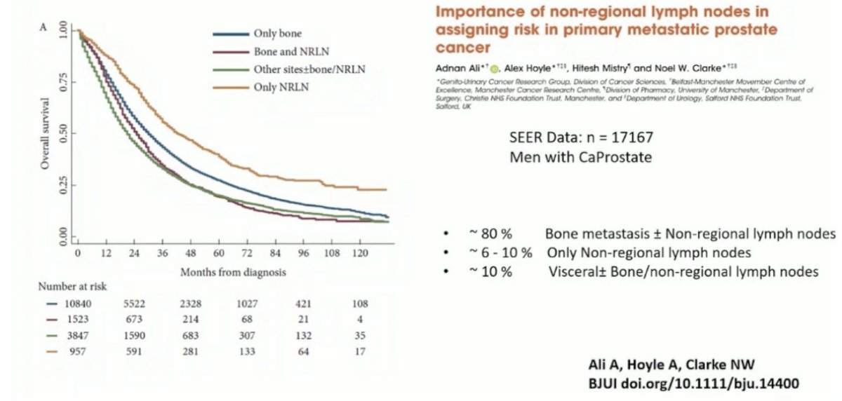 Dr. Salgado highlighted the prognostic significance of the site of metastasis in men with de novo metastatic prostate cancer. Drawing from SEER data on over 17,000 patients, he emphasized that approximately 80% present with bone metastases, often with or without non-regional lymph node (NRLN) involvement. However, a smaller subset (6–10%) present with metastases limited to NRLNs, and around 10% have visceral metastases with or without bone or NRLN involvement. Survival outcomes varied notably by site: patients with isolated NRLN metastases had the most favorable survival, followed by those with bone-only disease, while those with visceral involvement fared worst as outlined below. (1)