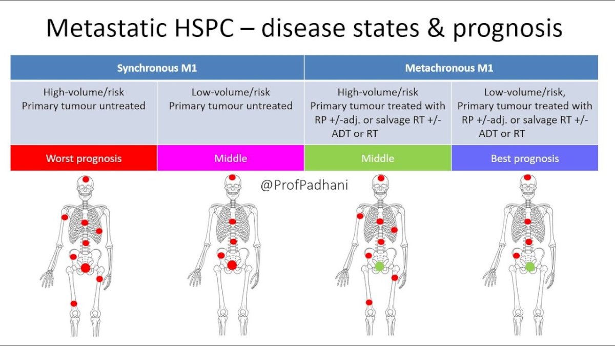 Dr. Chavarriaga then discussed biomarkers in the mHSPC setting, for which there is heterogeneity in outcomes depending on disease presentation and volume/risk of disease: