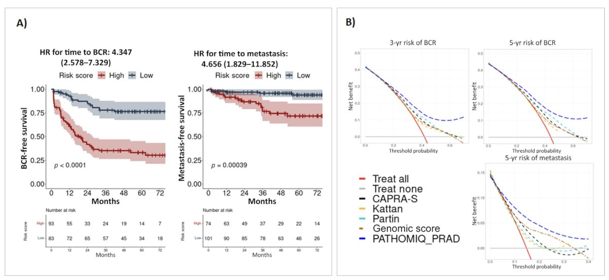 Moreover, Dr. Cooperberg highlighted the role of Pathomiq’s AI-based pathology platform in risk stratification. Patients classified as high-risk by the Pathomiq score had significantly worse biochemical recurrence-free survival (HR 4.35, p<0.0001) and metastasis-free survival (HR 4.66, p=0.00039) compared to low-risk patients. Importantly, decision curve analysis demonstrated that Pathomiq outperformed traditional clinical models (CAPRA-S, Kattan, Partin) and even genomic scores, providing greater net clinical benefit for predicting 3-year and 5-year risk of recurrence or metastasis.8
