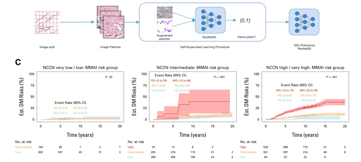 This suggests that MMAI may add important prognostic value beyond standard clinical classifiers, particularly in identifying the subset of men most likely to benefit from treatment intensification.