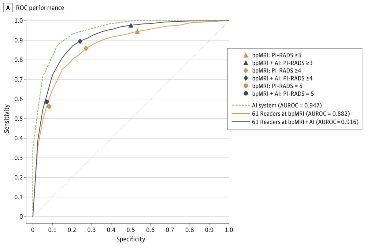This analysis showed that AI not only improved human reader performance but, when applied alone, actually outperformed radiologists in prostate MRI interpretation. The PI-CAI system achieved an AUROC of 0.947, compared to 0.882 for radiologists, with combined AI + reader performance reaching 0.916. These results highlight that AI can function as a supportive tool to enhance radiologist accuracy or potentially take the lead in independent interpretation.3