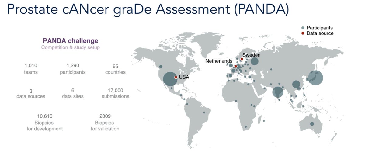 This initiative demonstrated the potential of AI to match or surpass pathologists in Gleason grading while reducing interobserver variability and promoting greater consistency in prostate cancer diagnosis worldwide (6) Dr Cooperberg highlighted this algorithm is opened source and can be easily downloaded and access anywhere in the world.