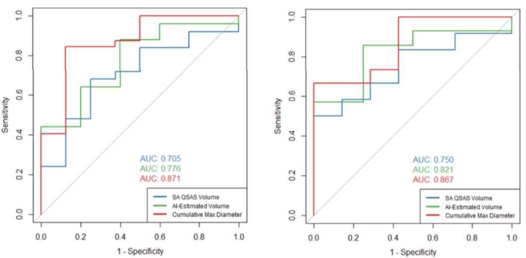 Interestingly however, in ROC analysis, pre-operative cumulative maximal stone diameter (AUC 0.871) outperformed both AI (AUC 0.776) and SA (AUC 0.751) volumes in predicting SFR-4 outcomes in small stones. However, Dr. Cabo mentions that for larger sized stones, the difference in predictive power was less apparent between all three measurement methods (Figure 2).