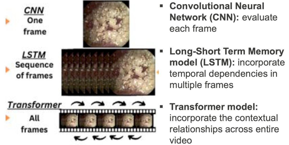 Each model was compared to the ground truth stone-free status obtained from postoperative computed tomography (CT) scans to assess for accuracy, sensitivity, and specificity. AUC-ROC analyzed the performance of each model. Additionally, 7 board-certified urologists were included to predict stone-free status to compare their accuracy to the superior computer vision model.