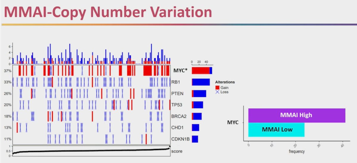 Dr. Sutera presented exploratory data linking MMAI scores with underlying genomic alterations in a cohort of 227 patients who underwent somatic DNA panel sequencing. Specifically, higher MMAI scores were significantly associated with MYC copy number gain, observed in 42% of patients, while other alterations such as RB1, PTEN, TP53, BRCA2, CHD1, and CDKN1B did not show a meaningful difference, as illustrated below. This finding suggests that MYC amplification may contribute to the aggressive biology captured by higher MMAI scores, reinforcing its potential role as a prognostic and biologically relevant biomarker