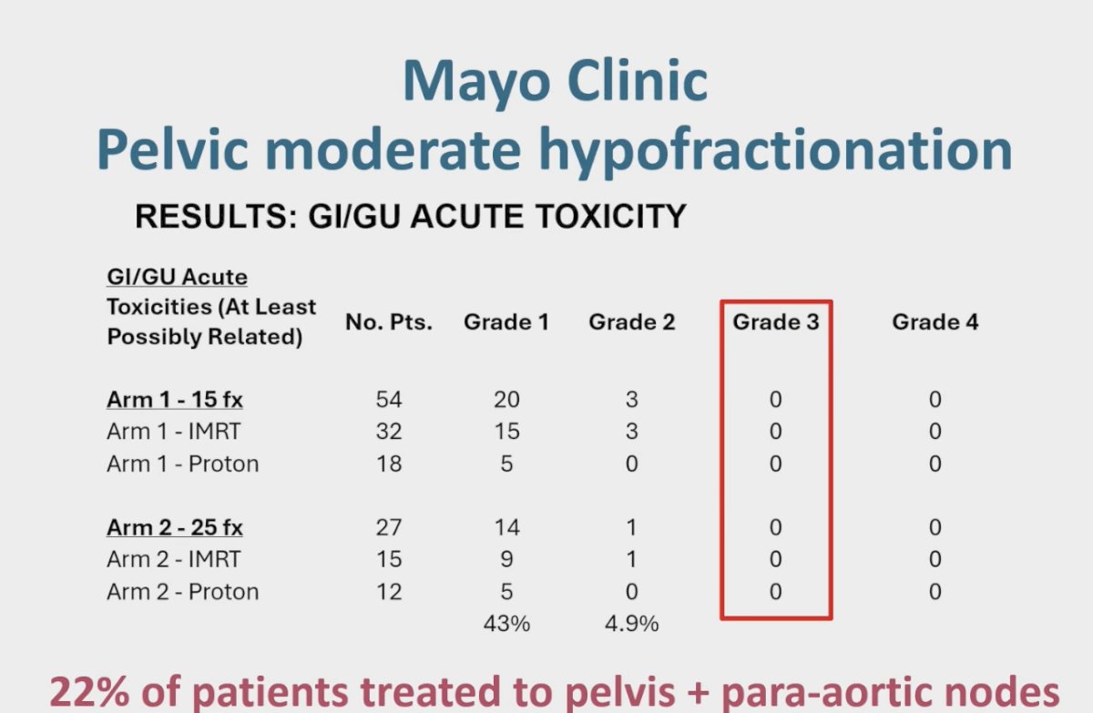Moving on, Dr. Jackson reviewed Dr. Davis’s randomized phase II trial from Mayo Clinic, which evaluated whether moderate hypofractionated pelvic and/or para-aortic radiotherapy increases GI or GU toxicity compared to conventional fractionation in patients with recurrent prostate cancer involving pelvic (N1) or para-aortic (M1a) nodes. Notably, 22% of patients were treated both to the pelvis and para-aortic nodes. The study demonstrated no increase in acute GI or GU toxicity with hypofractionation, and importantly, no grade 3 toxicities were observed in either arm. These findings are consistent with prior data, supporting the safety of moderate hypofractionation in the pelvic setting without compromising tolerability.&nbsp;