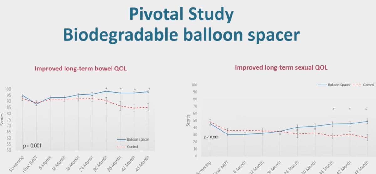 Dr. Jackson then discussed the BioProtect multinational pivotal randomized phase III trial, presented by Dr Song, which evaluated the use of a biodegradable balloon spacer in prostate cancer IMRT delivered as either moderately hypofractionated or conventional. The study demonstrated improved long-term bowel quality of life as well as improved long-term sexual quality of life, with these benefits persisting across extended follow-up.