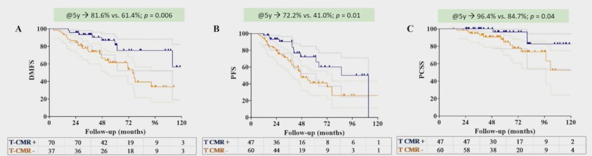 The median follow-up was 60.4 months. Among the 44 patients (41%) who experienced disease progression following radiotherapy, the median time to progression was 24.4 months (IQR: 11.3–40.3 months). Distant metastasis was the most common recurrence pattern, occurring in 77% of patients. Post-treatment 68Ga-PSMA-PET/CT, performed at a median of 4.1 months after radiotherapy, showed a reduction in SUVmax in 98.1% of primary tumors and 93.5% of lymph nodes. Complete metabolic response was achieved in 43.9% of primary tumors and 65.4% of lymph nodes. Patients achieving primary tumor complete metabolic response had significantly better 5-year outcomes, with distant metastasis-free survival at 81.6% compared to 61.4% (p = 0.006), progression-free survival at 72.2% versus 41.0% (p = 0.01), and prostate cancer-specific survival at 96.4% versus 84.7% (p = 0.04):