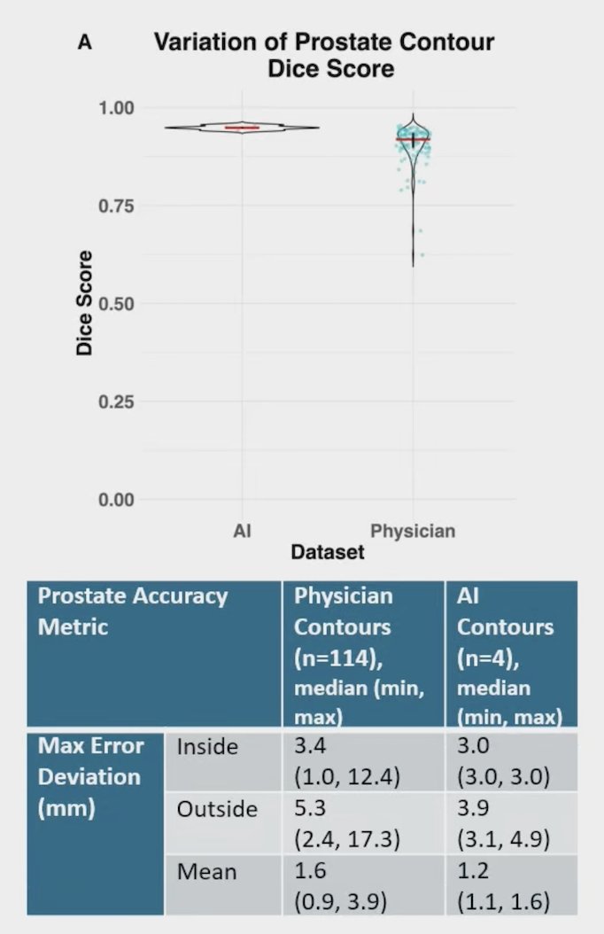 Maximum deviation inside (cutting into expert contour), maximum deviation outside (extending beyond expert contour), and mean deviation (per case) from the reference prostate were 3.4 mm (min 1.0, max 12.4), 5.3 mm (min 2.4, max 7.0), and 1.6 mm (min 1.3, max 17.3), respectively. By comparison, the prostate auto-segmentation tool had Dice similarity coefficient, max deviation inside, max distance outside, and mean deviation per case of 0.95 (min 0.94, max 0.96), 3 mm, 3.9 mm (min 3.1, max 4.9), and 1.2 mm (min 1.1, max 1.5), respectively: