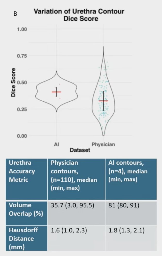 Physician performance was considerably worse for the urethra, with Dice similarity coefficient of 0.33 (min 0.03, max 0.69). Artificial intelligence tools contoured the urethra more accurately than physicians: