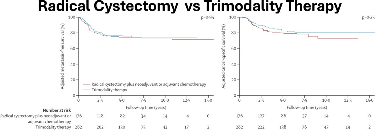 In well-selected patients with cT2-4N0M0 MIBC (i.e., tumors <7 cm, no or unilateral hydronephrosis, no extensive or multifocal CIS), radical cystectomy and TMT were associated with comparable metastasis-free and cancer-specific survival rates. However, distant metastatic rates remain high after either approach (~25%),1 and the early detection of metastases remains a major clinical challenge. Can we add circulating tumor DNA (ctDNA) to traditional surveillance protocols?&nbsp;