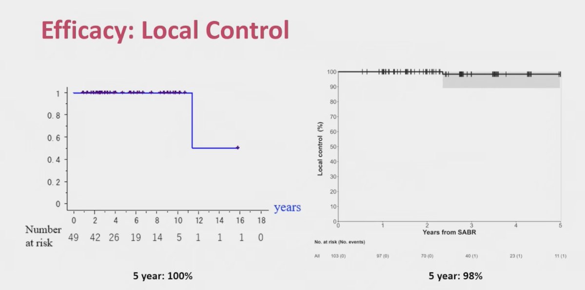 Notably, both studies demonstrated excellent long-term local control, with Dr. Onishi reporting 100% at 5 years and Dr. Siva’s pooled FASTRACK analysis showing 98% at 5 years, with only two documented failures to date.