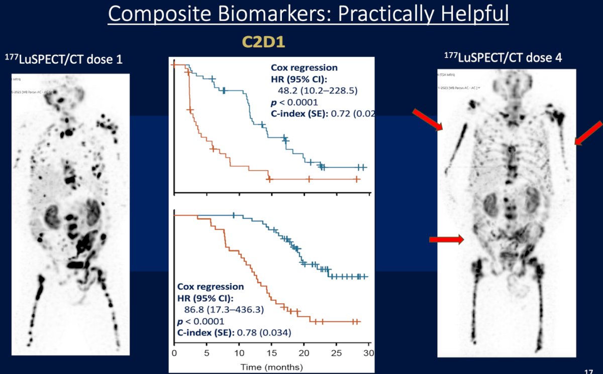 Dr. Emmett highlighted that composite biomarkers integrating both imaging (SPECT/CT) and molecular parameters are practically useful to predict outcomes during 177Lu-PSMA therapy. Early assessments at cycle 2, day 1 (C2D1) already stratify patients by prognosis, with a clear separation in survival curves (HR 48.2 for rPFS and HR 86.8 for OS; both p<0.0001). These composite approaches enable dynamic monitoring and early identification of responders versus non-responders across treatment cycles.