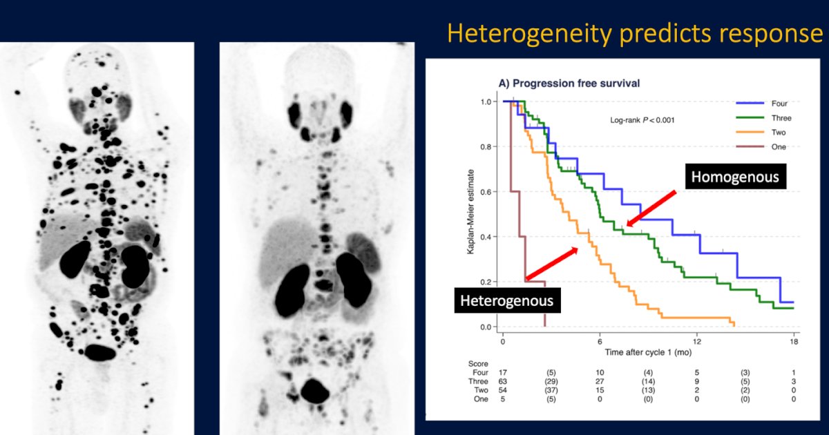 Moreover, Dr. Emmett highlighted that PSMA PET heterogeneity is a strong predictor of treatment response. She referenced data showing that patients with homogeneous and high-intensity PSMA expression experienced significantly better PSA and survival outcomes compared to those with heterogeneous uptake patterns. In the proposed 4-category HIT (heterogeneity and intensity of tumors) scoring system, increasing homogeneity and SUVmax were associated with improved PSA50 response rates, longer PSA-PFS, and overall survival.3