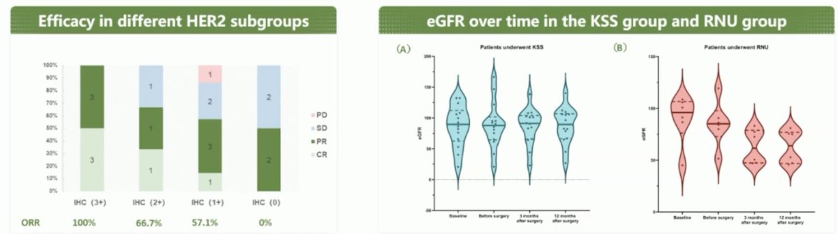 Tumor responses to induction therapy among the 20 patients included complete response (n = 5), partial response (n = 9), stable disease (n = 5), and progressive disease (n = 1), yielding an objective response rate of 70% and a disease control rate of 95%. Pathological examination confirmed a complete response in all 5 patients who had an achieved a clinical complete response. Treatment efficacy was strongly linked to higher levels of HER2 overexpression (2+/3+). The following figures highlight the efficacy in different HER2 subgroups and eGFR over time in the kidney-sparing surgery group and the radical nephroureterectomy group: