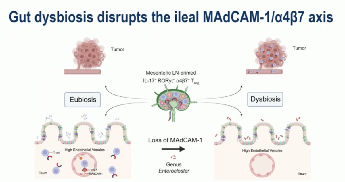 However, Dr. Machaalani explained that MAdCAM-1 expression differs markedly between patients with eubiosis and those with gut dysbiosis. In eubiosis, normal MAdCAM-1/α4β7 signaling supports T-cell homing and immune regulation within the ileum. In contrast, gut dysbiosis leads to a loss of MAdCAM-1 expression, particularly influenced by the presence of the bacterial genus Enterocloster, disrupting this immune axis. This loss of signaling compromises gut-immune communication, potentially facilitating tumor growth and altering systemic immune responses.
