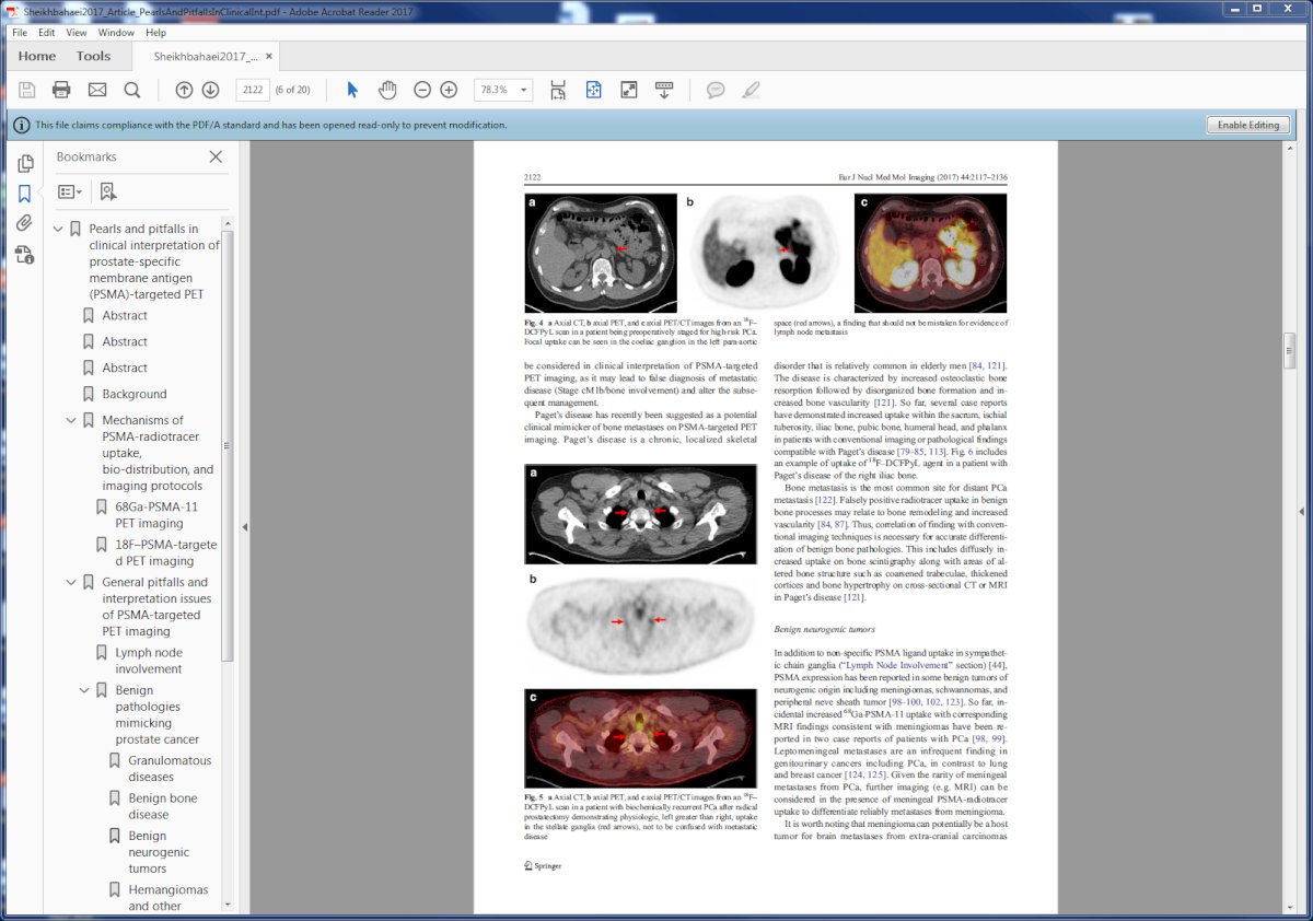 Uptake in ganglion structures (celiac ganglia):