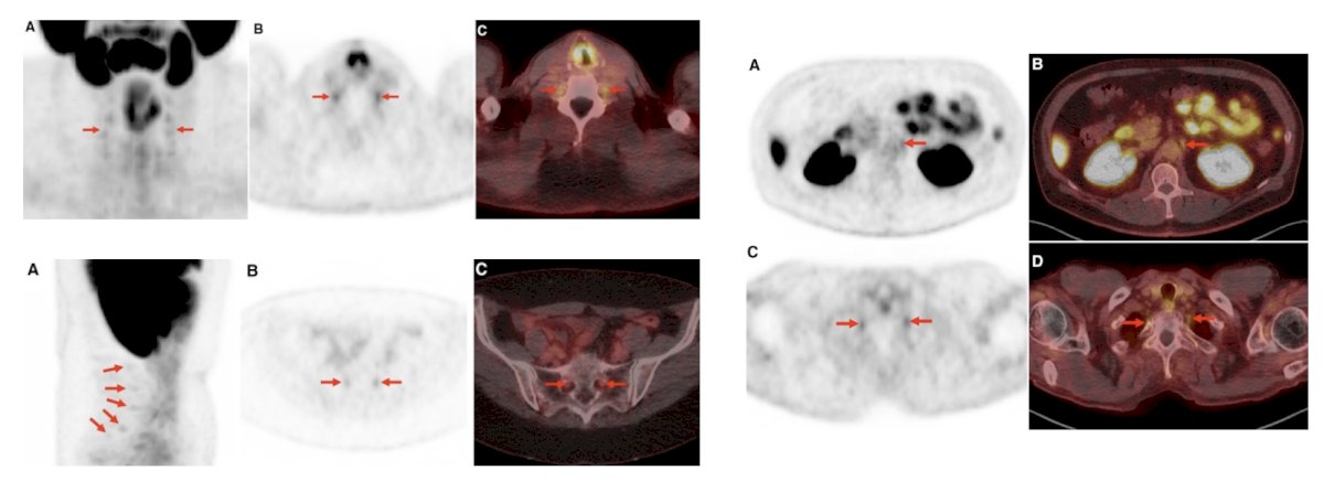 Uptake in peripheral ganglia: