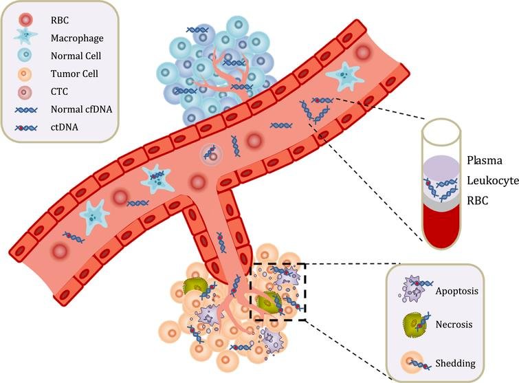 For the remainder of his presentation, Dr. Meeks discussed ctDNA, which, in his opinion, is the most important biomarker for muscle-invasive bladder cancer. ctDNA are small pieces of DNA that originate from cancerous cells and tumors. As a tumor grows, cells die and get broken down, releasing their cellular contents (including DNA) into the bloodstream. The amount of ctDNA that is detectable in the blood varies among individuals and will depend on the type of tumor, its location, and the stage of the tumour it comes from. ctDNA testing, also known as liquid biopsy, can be helpful in detecting and diagnosing a tumor, guiding more tailored, tumor-specific treatment, monitoring the effectiveness of a given treatment, and monitoring cancer recurrence:&nbsp;