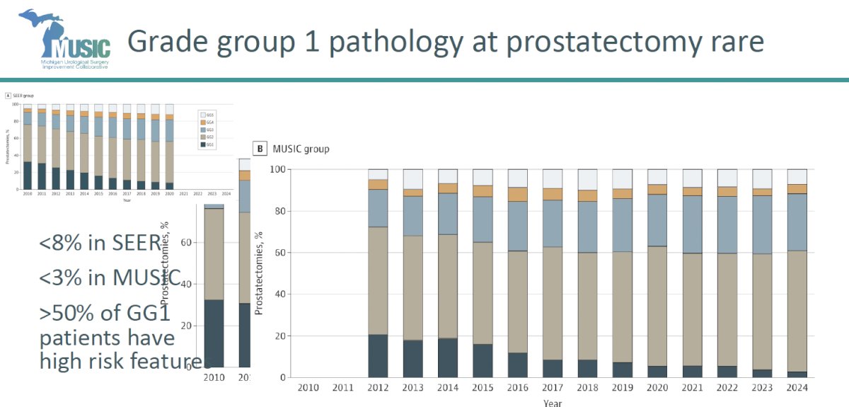 In modern practice, overtreatment of true GG1 disease is extremely uncommon:
