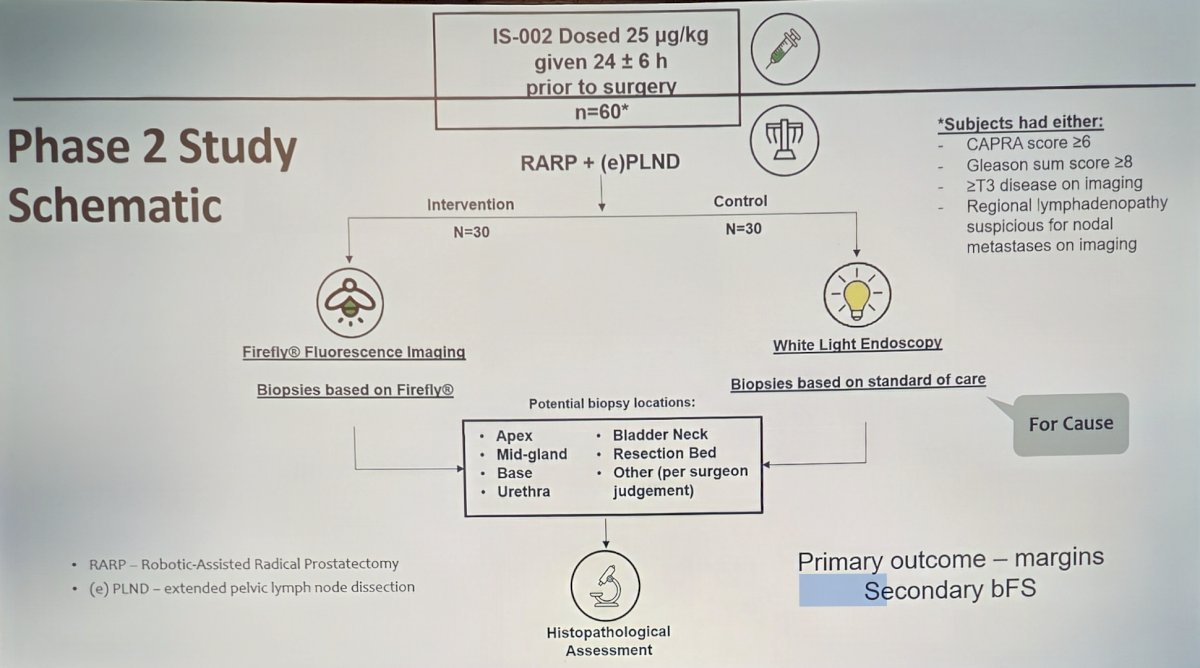 Dr. Carroll notes an upcoming phase 2 study evaluating the clinical impact on margin status and biochemical outcomes. The study will randomize 60 men with high-risk prostate cancer to the intervention arm of IS-002, given 24 hours +/- 6 hours prior to surgery, or the control arm of standard white-light endoscopy. The primary outcome is evaluation of surgical margins, and the secondary outcome is biochemical free survival. Potential biopsy locations include the apex, mid-gland, base, urethra, bladder neck, resection bed, or other (surgeon judgment):