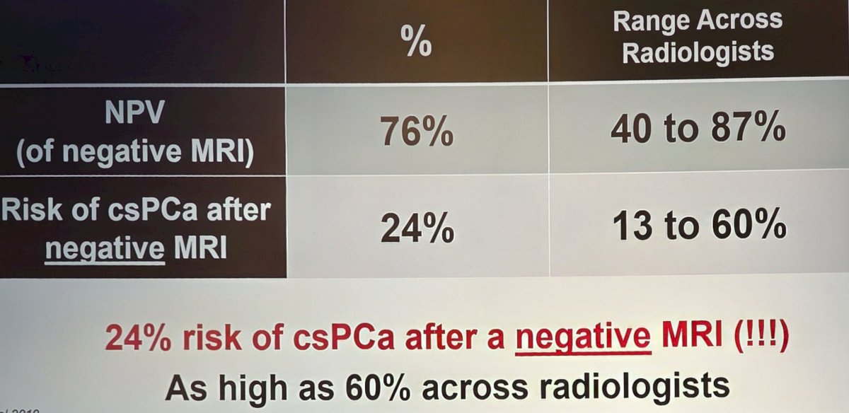 In 2019, Sonn et al.3 assessed prostate MRI interpretation variability across radiologists at Stanford University and the Palo Alto VA. There were 9 radiologists that assessed 409 patients, with a negative MRI defined as PI-RADS 1-2. They reported a low negative predictive value of 76% (range across radiologists of 40-87%), with a risk of clinically prostate cancer after a negative MRI of 24% (range across radiologists of 13-60%):