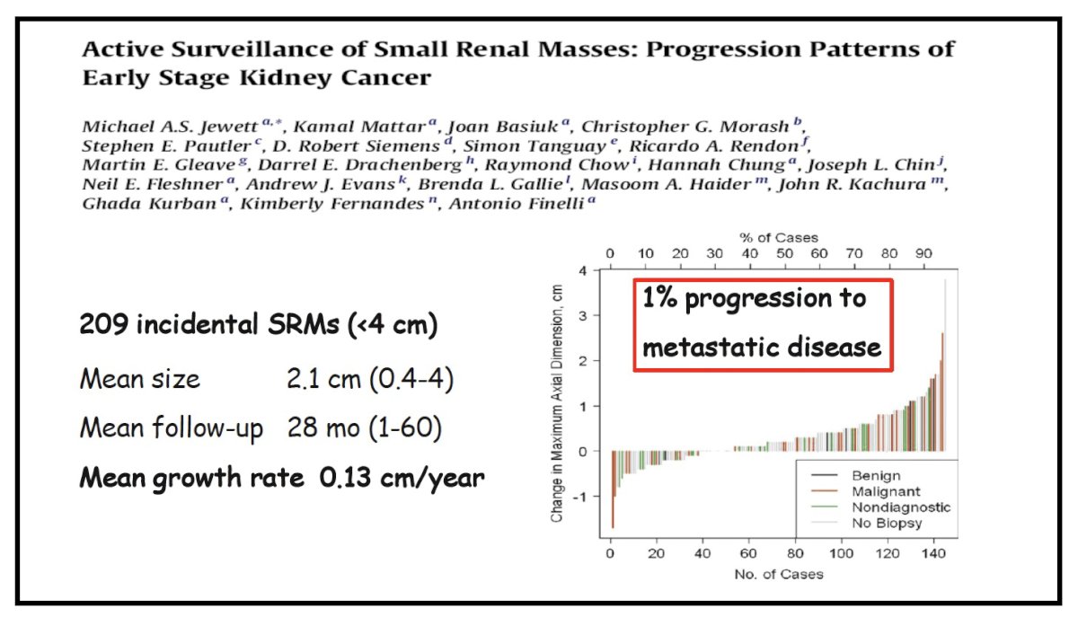 To validate the feasibility of AS in broader practice settings, the Canadian multi-center prospective study enrolled 209 patients across multiple institutions.2 The baseline tumor size averaged 2.1 cm, and the median follow-up was 28 months. The mean annual growth was only 0.13 cm, consistent with earlier reports. Renal mass biopsy was performed in nearly half the cohort, with a diagnostic yield of 67 percent. Among diagnostic biopsies, 82 percent confirmed RCC. Despite this high prevalence of malignancy, no patient developed metastasis except one, underscoring that histology alone cannot reliably predict aggressiveness and must be interpreted alongside longitudinal imaging behavior. This study was pivotal in demonstrating that AS is feasible not only in specialized academic centers but also across diverse, real-world environments.