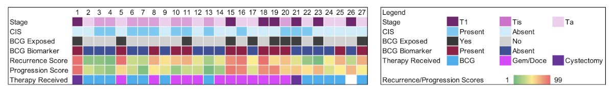 Of patients receiving intravesical therapy, 9/11 (82%) biomarker-present patients received gemcitabine + docetaxel and 2/11 (18%) received BCG, whereas 10/13 biomarker-absent patients received BCG and 3/13 (23%) received gemcitabine + docetaxel (due to BCG unavailability). One patient refused treatment and 2 underwent cystectomy, one due to aggressive recurrence, another after recurrent disease showed 95th&nbsp;percentile progression and recurrence risk scores: