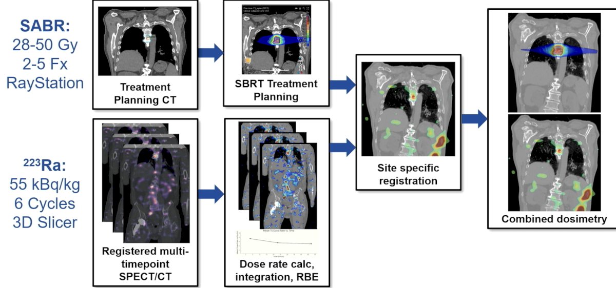 Standard of care photon stereotactic body radiotherapy plans were created in RayStation, and voxelwise radium-223 dose-rate maps were registered in 3D Slicer to the stereotactic body radiotherapy CT and integrated. The resultant absorbed dose was then imported and registered to the stereotactic body radiotherapy CT into the treatment planning system for voxelized summation. An alpha-particle relative biological effectiveness factor of 5 was applied to the radium-223 dose contribution. The dosimetry workflow for this study is as follows: