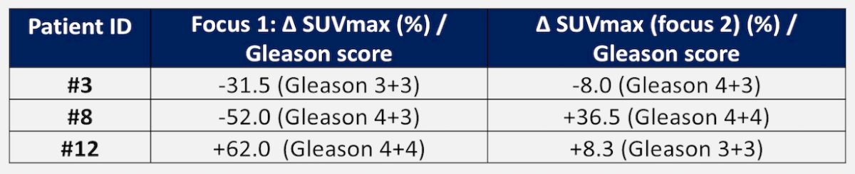 Results were similar in the per-protocol population (n = 14), with 5 patients (36%) having any SUVmax increase and 3 patients (21%) with an SUVmax ≥20% increase. Seven patients (50%; 90% CI 26.4-73.6) showed increased tumor volume (range: 6.2% to 98.6%), and SUVmean and total lesion PSMA increased in 3 patents (21.4%). There were no new pelvic or extrapelvic metastases detected after darolutamide treatment. Three patients had 2 prostate uptake foci, with heterogeneous changes in PSMA uptake after darolutamide:&nbsp;